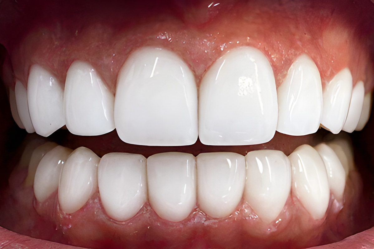 Case 02, After