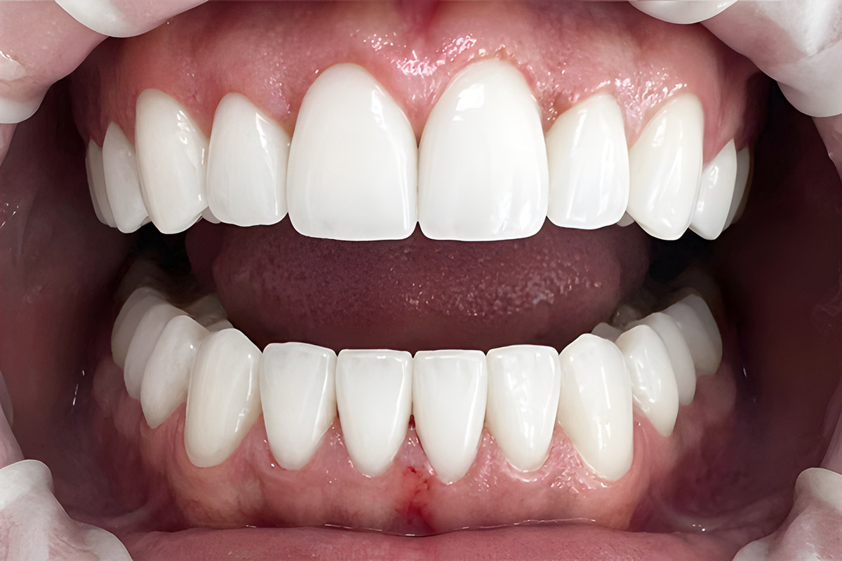 Case 05, After